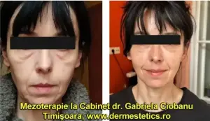 web design şi optimizare-promovare cabinet dermatologie